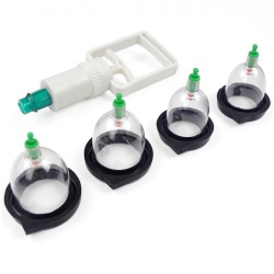 Electro Cupping Set van FM Electrosex - mae-fm-090