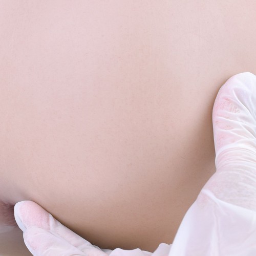 opr-1461123 8721284281443